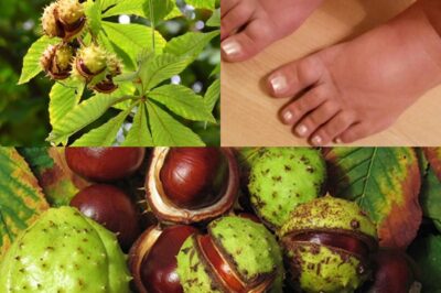 This Ancient Tree Is Healing Millions: Horse Chestnut’s Shocking Ability to Eliminate Swollen Legs and Poor Circulation!