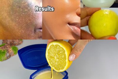 You’ll NEVER Use Expensive Creams Again After Trying THIS Simple Vaseline and Lemon Trick for Dark Spots and Wrinkles!