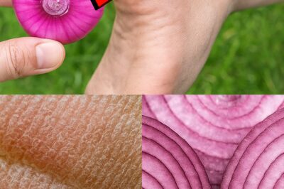 Say Goodbye to Cracked Heels Forever! Discover the Magical Home Remedy for Smooth, Beautiful Feet! Are cracked heels ruining your confidence? We’ve got the solution! This simple yet powerful home remedy will help you achieve silky smooth feet that you’ll be proud to show off. The best part? It’s easy to make and completely natural!