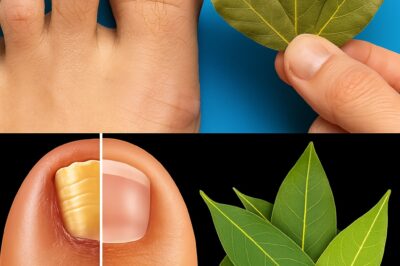 Say goodbye to nail fungus for good! Ditch those pricey pharmacy treatments and try this game-changing natural remedy instead. Want to know the secret ingredient that’s about to become your new BFF? Method below comment 👇