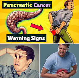 Early detection is key to increasing the chances of survival. Understanding and recognizing the early warning signs of pancreatic cancer could potentially save your life. 8 Silent Signs of Pancreatic Cancer You Should Never Ignore.