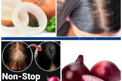 Dealing with constant hair fall, thinning strands, or slow growth? Nature has your back—with something as simple as onion hair oil. This powerful, homemade remedy is rich in sulfur, antioxidants, and antimicrobial properties, making it a game-changer for your scalp and strands.
