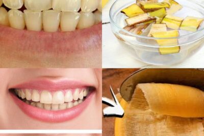 🔥 Dentists HATE this 2-minute trick! 🔥 Yep, they’ve been gatekeeping it like it’s national security. But guess what? You can blast off tartar and get that “celebrity smile” ✨ right at home—no bleach, no $300 cleanings, no BS.